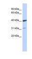VSX1 Antibody - VSX1 antibody Western blot of 721_B cell lysate. This image was taken for the unconjugated form of this product. Other forms have not been tested.