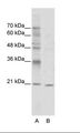 VSX1 Antibody - A: Marker, B: Jurkat Cell Lysate.  This image was taken for the unconjugated form of this product. Other forms have not been tested.