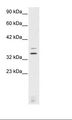 VSX2 / CHX10 Antibody - Jurkat Cell Lysate.  This image was taken for the unconjugated form of this product. Other forms have not been tested.