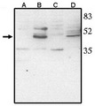 VSX2 / CHX10 Antibody - Western blot of anti-Chk10 (CT) antibody at 1 ug/ml on rat liver (A), retina tissue lysate (B), mouse liver (C) and retina (D) tissue lysate.