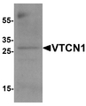 VTCN1 / B7-H4 Antibody - Western blot analysis of VTCN1 in EL4 cell lysate with VTCN1 antibody at 1 ug/ml.