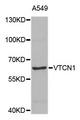 VTCN1 / B7-H4 Antibody - Western blot blot of extracts of A549 cells, using VTCN1 antibody.