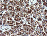 VTI1A Antibody - IHC of paraffin-embedded Human pancreas tissue using anti-VTI1A mouse monoclonal antibody. (Heat-induced epitope retrieval by 10mM citric buffer, pH6.0, 120°C for 3min).