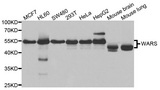 WARS Antibody - Western blot analysis of extracts of various cell lines.