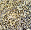 WAS / WASP Antibody - WAS Antibody IHC of formalin-fixed and paraffin-embedded tonsil tissue followed by peroxidase-conjugated secondary antibody and DAB staining.