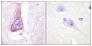 WAS / WASP Antibody - Peptide - + Immunohistochemistry analysis of paraffin-embedded human brain tissue using WASP (Ab-290) antibody.