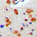 WAS / WASP Antibody - Immunohistochemical analysis of WASP (pY290) staining in human brain formalin fixed paraffin embedded tissue section. The section was pre-treated using heat mediated antigen retrieval with sodium citrate buffer (pH 6.0). The section was then incubated with the antibody at room temperature and detected using an HRP conjugated compact polymer system. DAB was used as the chromogen. The section was then counterstained with hematoxylin and mounted with DPX.