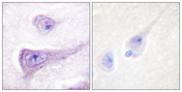 WAS / WASP Antibody - P-peptide - + Immunohistochemistry analysis of paraffin-embedded human brain tissue using WASP (Phospho-Tyr290) antibody.
