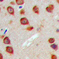 WASF3 Antibody - Immunohistochemical analysis of WASF3 staining in human brain formalin fixed paraffin embedded tissue section. The section was pre-treated using heat mediated antigen retrieval with sodium citrate buffer (pH 6.0). The section was then incubated with the antibody at room temperature and detected using an HRP-conjugated compact polymer system. DAB was used as the chromogen. The section was then counterstained with hematoxylin and mounted with DPX.
