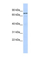 WBP11 Antibody - WBP11 antibody Western blot of HeLa lysate. This image was taken for the unconjugated form of this product. Other forms have not been tested.