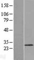 WBSCR27 Protein - Western validation with an anti-DDK antibody * L: Control HEK293 lysate R: Over-expression lysate