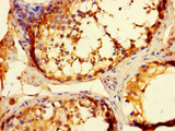 WBSCR28 Antibody - Immunohistochemistry of paraffin-embedded human testis tissue using WBSCR28 Antibody at dilution of 1:100