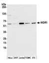 WDR1 Antibody - Detection of human and mouse WDR1 by western blot. Samples: Whole cell lysate (50 µg) from HeLa, HEK293T, Jurkat, mouse TCMK-1, and mouse NIH 3T3 cells. Antibody: Affinity purified rabbit anti-WDR1 antibody used for WB at 0.1 µg/ml. Detection: Chemiluminescence with an exposure time of 30 seconds.