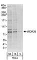 WDR26 Antibody - Detection of Human WDR26 by Western Blot. Samples: Whole cell lysate (5, 15 and 50 ug) from HeLa cells. Antibodies: Affinity purified rabbit anti-WDR26 antibody used for WB at 0.4 ug/ml. Detection: Chemiluminescence with an exposure time of 30 seconds.