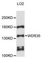 WDR35 Antibody - Western blot analysis of extracts of LO2 cells, using WDR35 antibody at 1:3000 dilution. The secondary antibody used was an HRP Goat Anti-Rabbit IgG (H+L) at 1:10000 dilution. Lysates were loaded 25ug per lane and 3% nonfat dry milk in TBST was used for blocking. An ECL Kit was used for detection and the exposure time was 90s.