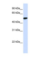 WDR4 Antibody - WDR4 antibody Western blot of Placenta lysate. This image was taken for the unconjugated form of this product. Other forms have not been tested.