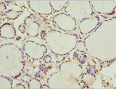 WDR47 Antibody - Immunohistochemistry of paraffin-embedded human thyroid tissue at dilution 1:100