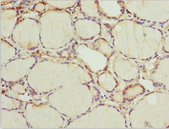 WDR47 Antibody - Immunohistochemistry of paraffin-embedded human thyroid tissue at dilution 1:100
