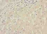 WDR74 Antibody - Immunohistochemistry of paraffin-embedded human liver tissue using antibody at dilution of 1:100.