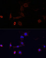 WDR81 Antibody - Immunofluorescence analysis of PC12 cells using WDR81 antibody at dilution of 1:100. Blue: DAPI for nuclear staining.