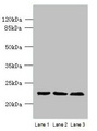 WDYHV1 Antibody - Western blot All lanes: WDYHV1 antibody at 6µg/ml Lane 1: Mouse heart tissue Lane 2: MCF-7 whole cell lysate Lane 3: U251 whole cell lysate Secondary Goat polyclonal to rabbit IgG at 1/10000 dilution Predicted band size: 24, 17 kDa Observed band size: 24 kDa