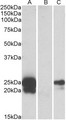 WFDC2 / HE4 Antibody - HEK293 lysate (10ug protein in RIPA buffer) overexpressing Human WFDC2 with C-terminal MYC tag probed with (1ug/ml) in Lane A and probed with anti-MYC Tag (1/1000) in lane C. Mock-transfected HEK293 probed (1mg/ml) in Lane B. Primary