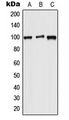 WFS1 Antibody - Western blot analysis of WFS1 expression in HeLa (A); Raw264.7 (B); H9C2 (C) whole cell lysates.