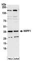 WIPF1 / WIP Antibody - Detection of human WIPF1 by western blot. Samples: Whole cell lysate (50 µg) from HeLa and Jurkat cells prepared using NETN lysis buffer. Antibody: Affinity purified rabbit anti-WIPF1 antibody used for WB at 0.1 µg/ml. Detection: Chemiluminescence with an exposure time of 3 minutes.