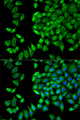 WNK1 Antibody - Immunofluorescence analysis of HeLa cells.