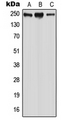 WNK2 Antibody - Western blot analysis of WNK2 expression in HeLa (A); MCF7 (B); SP2/0 (C) whole cell lysates.