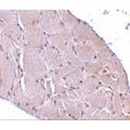 WNT10A Antibody - Immunohistochemistry of Wnt10a in human skeletal muscle tissue with Wnt10a antibody at 10 µg/mL.