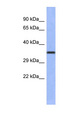WNT4 Antibody - WNT4 antibody Western blot of Jurkat lysate. This image was taken for the unconjugated form of this product. Other forms have not been tested.