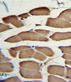 WNT5B Antibody - Formalin-fixed and paraffin-embedded human skeletal muscle with WNT5B Antibody , which was peroxidase-conjugated to the secondary antibody, followed by DAB staining. This data demonstrates the use of this antibody for immunohistochemistry; clinical relevance has not been evaluated.