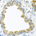 WNT5B Antibody - Immunohistochemistry of paraffin-embedded mouse lung tissue.