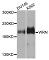 WRN Antibody - Western blot analysis of extracts of various cells.