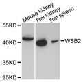 WSB2 Antibody - Western blot analysis of extracts of various cell lines, using WSB2 antibody at 1:3000 dilution. The secondary antibody used was an HRP Goat Anti-Rabbit IgG (H+L) at 1:10000 dilution. Lysates were loaded 25ug per lane and 3% nonfat dry milk in TBST was used for blocking. An ECL Kit was used for detection and the exposure time was 90s.