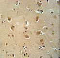 WWC3 Antibody - WWC3 antibody immunohistochemistry of formalin-fixed and paraffin-embedded human brain tissue followed by peroxidase-conjugated secondary antibody and DAB staining.