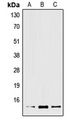 XCL2 Antibody - Western blot analysis of XCL2 expression in Jurkat (A); mouse liver (B); rat liver (C) whole cell lysates.