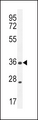 XCR1 Antibody - XCR1 Antibody western blot of MDA-MB435 cell line lysates (35 ug/lane). The XCR1 antibody detected the XCR1 protein (arrow).