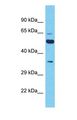 XKR5 Antibody - Western blot of XKR5 Antibody with human A549 Whole Cell lysate.  This image was taken for the unconjugated form of this product. Other forms have not been tested.