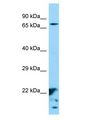 XKR6 Antibody - XKR6 antibody Western Blot of HepG2. Antibody dilution: 1 ug/ml.  This image was taken for the unconjugated form of this product. Other forms have not been tested.