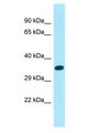 XKR6 Antibody - XKR6 antibody Western Blot of MCF7. Antibody dilution: 1 ug/ml.  This image was taken for the unconjugated form of this product. Other forms have not been tested.