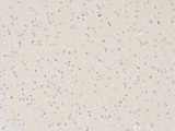 XPA Antibody - Immunohistochemistry of paraffin-embedded rat brain using XPA antibody at dilution of 1:200 (200x lens).