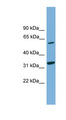 XPNPEP3 Antibody - XPNPEP3 antibody Western blot of MCF7 cell lysate. This image was taken for the unconjugated form of this product. Other forms have not been tested.