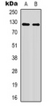 XPO1 / CRM1 Antibody - Western blot analysis of XPO1 (AcK568) expression in HepG2 UV-treated (A); mouse brain (B) whole cell lysates.