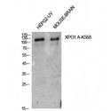XPO1 / CRM1 Antibody - Western blot of Acetyl-CRM1 (K568) antibody