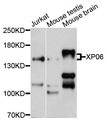 XPO6 Antibody - Western blot analysis of extracts of various cell lines, using XPO6 antibody at 1:1000 dilution. The secondary antibody used was an HRP Goat Anti-Rabbit IgG (H+L) at 1:10000 dilution. Lysates were loaded 25ug per lane and 3% nonfat dry milk in TBST was used for blocking. An ECL Kit was used for detection and the exposure time was 5s.