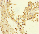 XPO6 Antibody - Immunohistochemistry of paraffin-embedded human testis tissue at dilution of 1:100