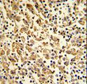 XPOT / Exportin-T Antibody - Formalin-fixed and paraffin-embedded human lymph with XPOT Antibody , which was peroxidase-conjugated to the secondary antibody, followed by DAB staining. This data demonstrates the use of this antibody for immunohistochemistry; clinical relevance has not been evaluated.