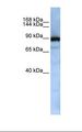 XPOT / Exportin-T Antibody - Jurkat cell lysate. Antibody concentration: 1.0 ug/ml. Gel concentration: 6-18%.  This image was taken for the unconjugated form of this product. Other forms have not been tested.
